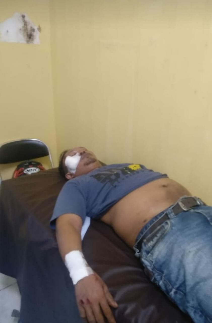 Miris... Nasib Wartawan RMOL.id, Sudah Ditabrak Diperas Pula