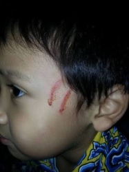 Bocah 5 Tahun Diduga Jadi Korban Penganiayaan Guru PAUD