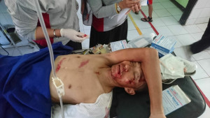 Atlet Balap Sepeda Asian Games Alami Kecelakaan Mobil