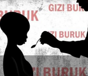 Tangani Gizi Buruk,  Pemda Aceh Gandeng UNICEF